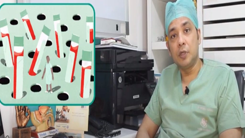 Prostate Cancer Complete Guide